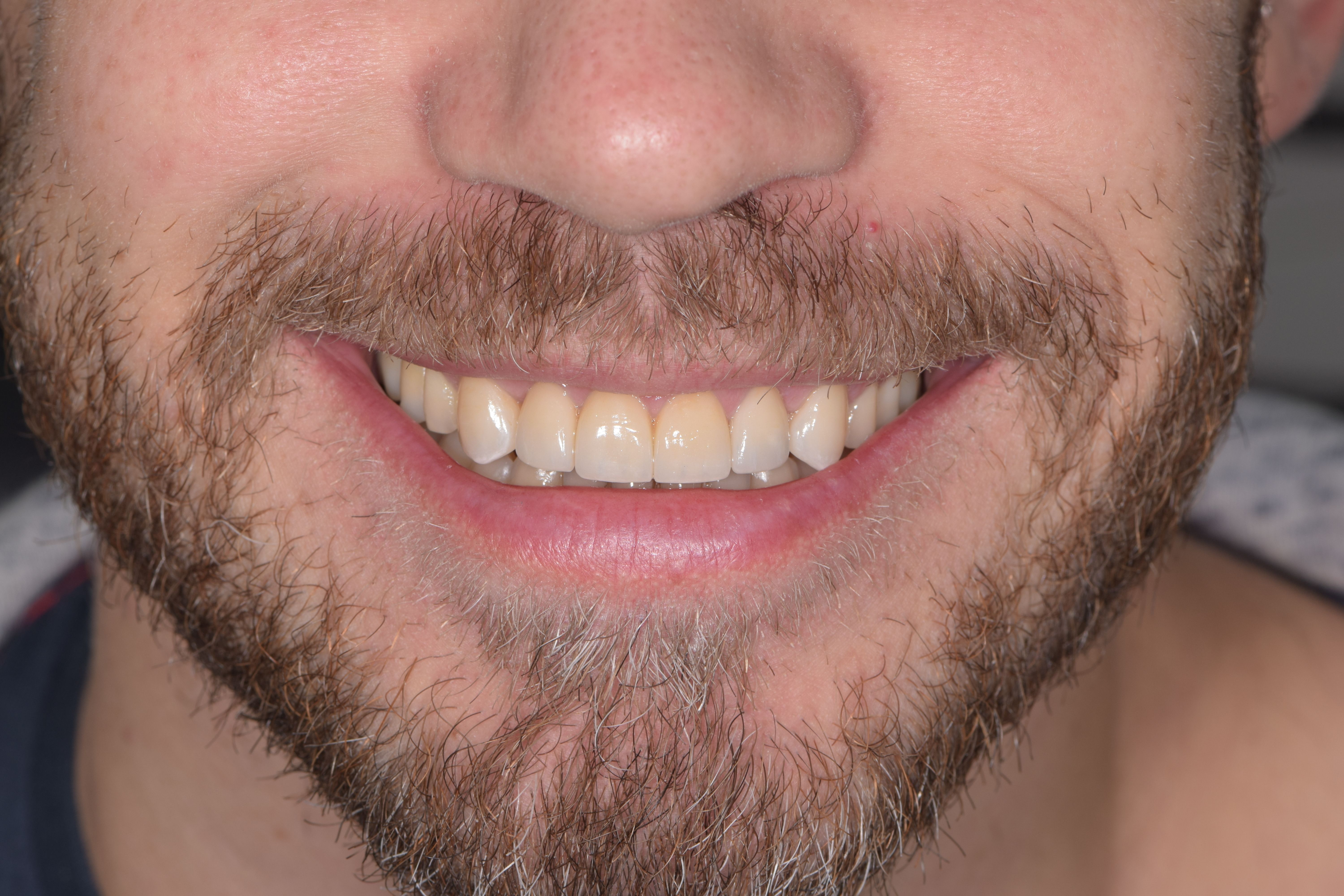posle profil1.3