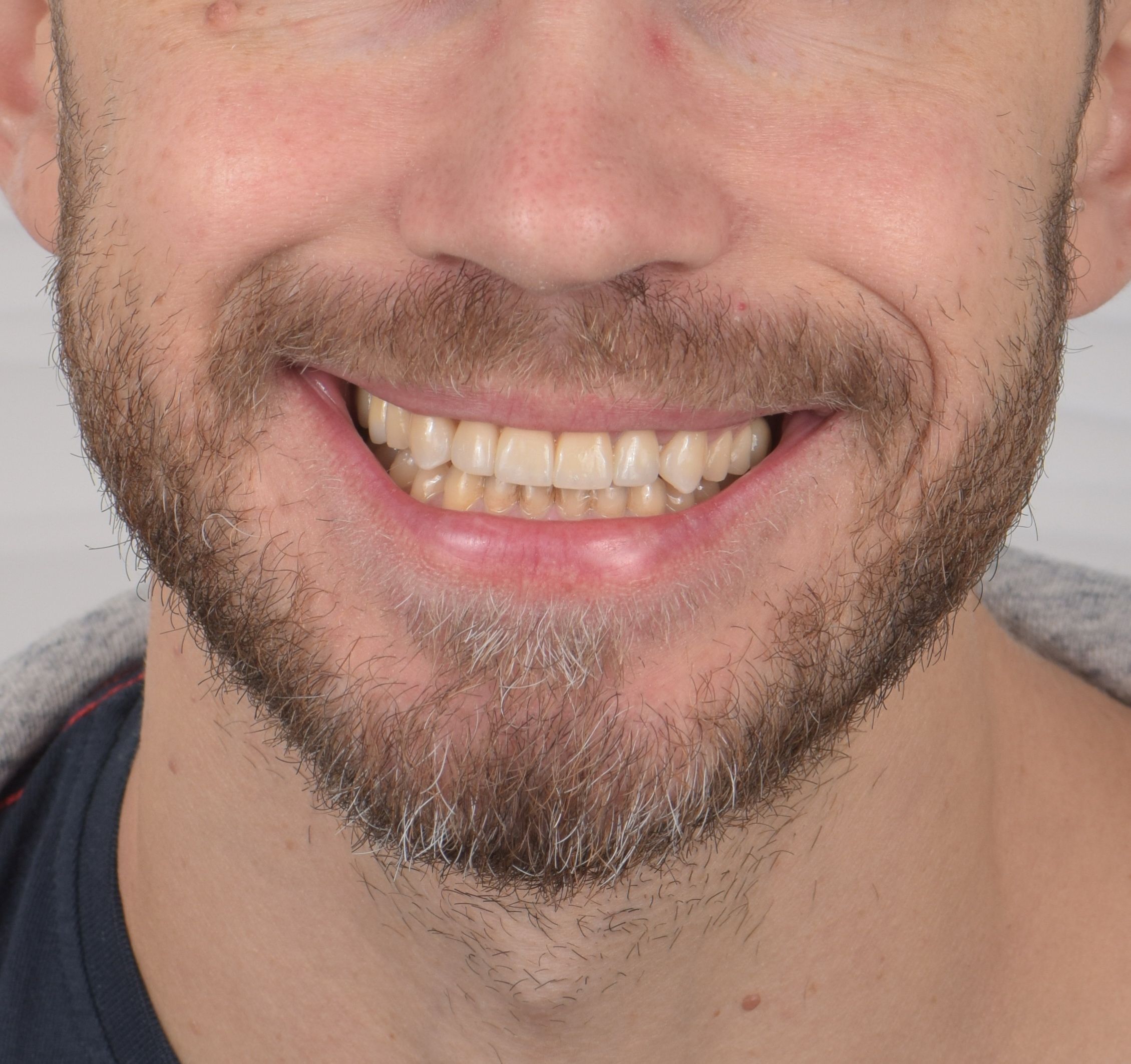 posle profil1.6
