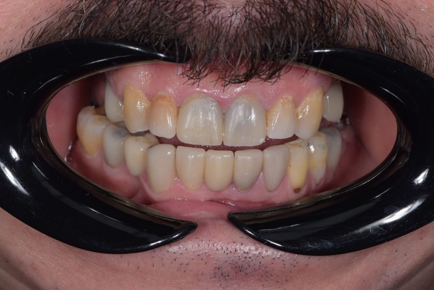 DSC 1141