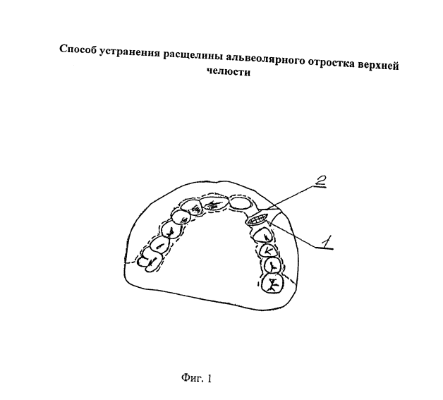 Фигура 1. Схема из патента RU 2668807 C1; обозначения расшифрованы в описании изобретения