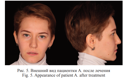Рисунок 5. Внешний вид пациентки А. после лечения