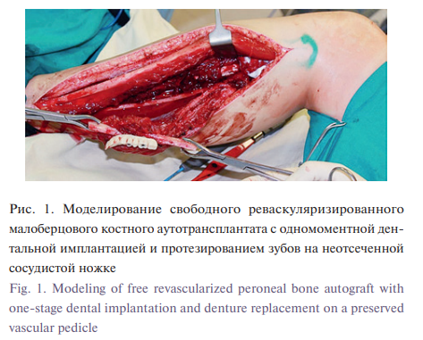 Рисунок 1 из статьи о формировании мягких тканей; полная подпись приведена ниже
