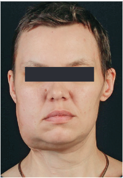 Рис. 1. Фото пациентки до лечения